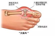 各年龄段血压、血糖、血脂、尿酸对照表，看这里！