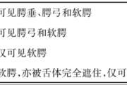 Mallampati分级