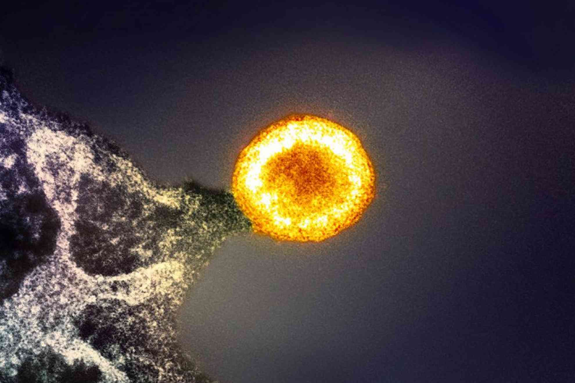 HIV-virus(1).jpg